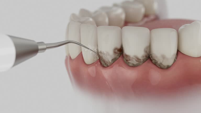 Trusted Emergency Dentist service in Lake Wilderness, VA - Dentist Open Now